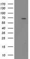 Beta-Transducin Repeat Containing E3 Ubiquitin Protein Ligase antibody, CF502464, Origene, Western Blot image 