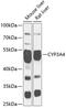Cytochrome P450 Family 3 Subfamily A Member 4 antibody, GTX66192, GeneTex, Western Blot image 