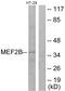 Myocyte Enhancer Factor 2B antibody, PA5-38651, Invitrogen Antibodies, Western Blot image 