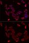 Pyruvate Dehydrogenase Complex Component X antibody, GTX54603, GeneTex, Immunocytochemistry image 