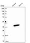 Sorting Nexin 10 antibody, NBP1-86456, Novus Biologicals, Western Blot image 