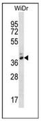 Pepsin A antibody, AP53267PU-N, Origene, Western Blot image 