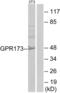 Probable G-protein coupled receptor 173 antibody, abx015262, Abbexa, Western Blot image 