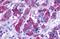 BKRB1 antibody, GTX70845, GeneTex, Immunohistochemistry paraffin image 