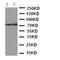 ATP Binding Cassette Subfamily G Member 4 antibody, PA5-78700, Invitrogen Antibodies, Western Blot image 