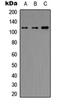 Histone Deacetylase 5 antibody, orb256586, Biorbyt, Western Blot image 