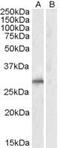Siah E3 Ubiquitin Protein Ligase 1 antibody, ab2237, Abcam, Western Blot image 