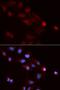 Small Nuclear Ribonucleoprotein Polypeptide E antibody, LS-C334087, Lifespan Biosciences, Immunofluorescence image 