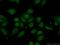 Histone-binding protein RBBP4 antibody, 14557-1-AP, Proteintech Group, Immunofluorescence image 