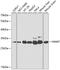 Histamine N-methyltransferase antibody, GTX54118, GeneTex, Western Blot image 