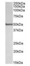 BLK Proto-Oncogene, Src Family Tyrosine Kinase antibody, orb22560, Biorbyt, Western Blot image 