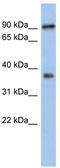 Radial Spoke Head 10 Homolog B antibody, TA335121, Origene, Western Blot image 