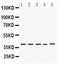 Doublesex And Mab-3 Related Transcription Factor 1 antibody, PA5-79160, Invitrogen Antibodies, Western Blot image 