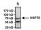 Heat shock 70 kDa protein 1A/1B antibody, MA3-014, Invitrogen Antibodies, Immunoprecipitation image 