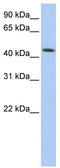 Vacuolar Protein Sorting 4 Homolog A antibody, TA334465, Origene, Western Blot image 