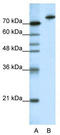 Kelch-like protein 3 antibody, TA345214, Origene, Western Blot image 