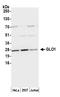 Glyoxalase I antibody, A305-291A, Bethyl Labs, Western Blot image 