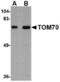 Translocase Of Outer Mitochondrial Membrane 70 antibody, TA306698, Origene, Western Blot image 