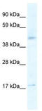 5-Hydroxytryptamine Receptor 1F antibody, TA330006, Origene, Western Blot image 