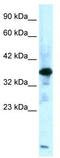 Zinc finger protein-like 1 antibody, TA335674, Origene, Western Blot image 