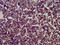 Spindle And Kinetochore Associated Complex Subunit 1 antibody, LS-C674561, Lifespan Biosciences, Immunohistochemistry paraffin image 