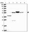 Acyl-CoA Synthetase Medium Chain Family Member 6 antibody, PA5-60768, Invitrogen Antibodies, Western Blot image 