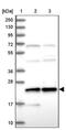 Jupiter Microtubule Associated Homolog 2 antibody, PA5-59779, Invitrogen Antibodies, Western Blot image 