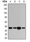Bile acid-CoA:amino acid N-acyltransferase antibody, abx225056, Abbexa, Western Blot image 