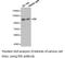 Insulin Degrading Enzyme antibody, LS-C193018, Lifespan Biosciences, Western Blot image 