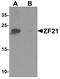 Zinc finger FYVE domain-containing protein 21 antibody, A14319, Boster Biological Technology, Western Blot image 