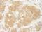 ARF GTPase-activating protein GIT1 antibody, A302-101A, Bethyl Labs, Immunohistochemistry paraffin image 