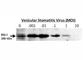 DExD/H-Box Helicase 58 antibody, F46991-0.4ML, NSJ Bioreagents, Western Blot image 