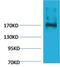 Ectopic P-Granules Autophagy Protein 5 Homolog antibody, GTX34365, GeneTex, Western Blot image 