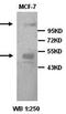 Heat Shock Protein Family A (Hsp70) Member 5 antibody, orb76914, Biorbyt, Western Blot image 