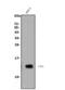 Lymphocyte antigen 6A-2/6E-1 antibody, A30403, Boster Biological Technology, Western Blot image 