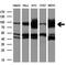 Aldehyde Dehydrogenase 1 Family Member L1 antibody, GTX84894, GeneTex, Western Blot image 