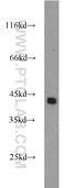 DNA Fragmentation Factor Subunit Alpha antibody, 10191-2-AP, Proteintech Group, Western Blot image 
