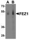 Fasciculation And Elongation Protein Zeta 1 antibody, A04986, Boster Biological Technology, Western Blot image 