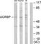 Acrosin Binding Protein antibody, TA315919, Origene, Western Blot image 