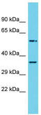 Ring Finger Protein 14 antibody, TA342341, Origene, Western Blot image 