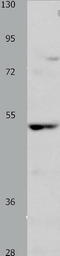 NCK Adaptor Protein 1 antibody, TA324087, Origene, Western Blot image 