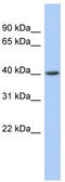 Acyl-CoA Dehydrogenase Short Chain antibody, TA336255, Origene, Western Blot image 