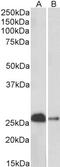 Calbindin 1 antibody, LS-B11187, Lifespan Biosciences, Western Blot image 
