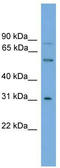 UDP Glucuronosyltransferase Family 1 Member A5 antibody, TA331083, Origene, Western Blot image 