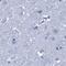 CYP51A1 antibody, PA5-59516, Invitrogen Antibodies, Immunohistochemistry frozen image 