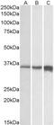 fTnT antibody, PA5-37899, Invitrogen Antibodies, Western Blot image 