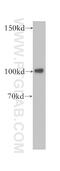 Plasminogen antibody, 18300-1-AP, Proteintech Group, Western Blot image 