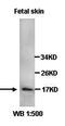 Keratin 1 antibody, orb77386, Biorbyt, Western Blot image 