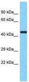 Methyltransferase Like 17 antibody, TA337431, Origene, Western Blot image 