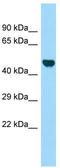 Leucine Rich Repeats And WD Repeat Domain Containing 1 antibody, TA330928, Origene, Western Blot image 